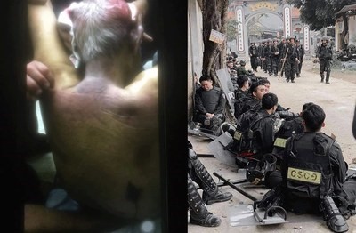Phần lưng ông Lê Đình Kinh với nhiều vết bầm tím (ảnh trái), cảnh sát cơ động vào xã Đồng Tâm hôm 9/1/2020 (ảnh phải)